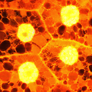 A fruit fly’s salivary gland viewed under a microscope.